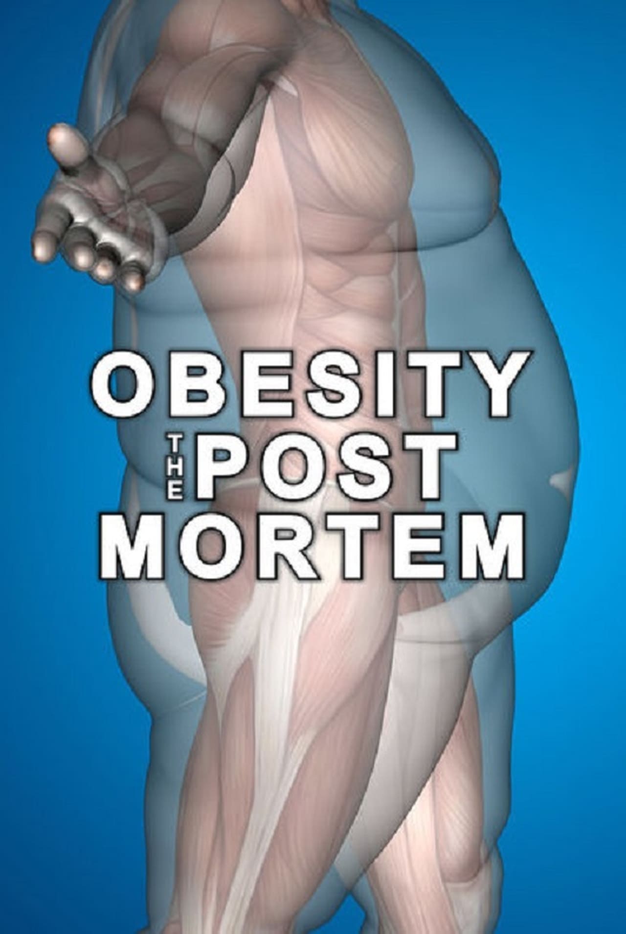 Películas Obesity: The Post Mortem