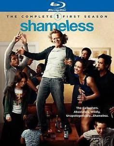 Serie Shameless