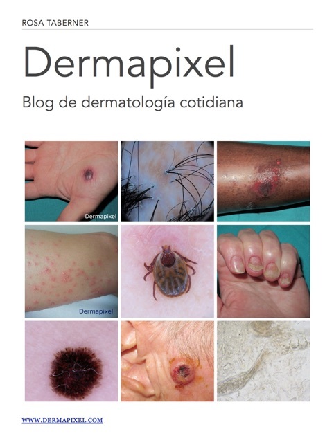 Moda Dermapixel