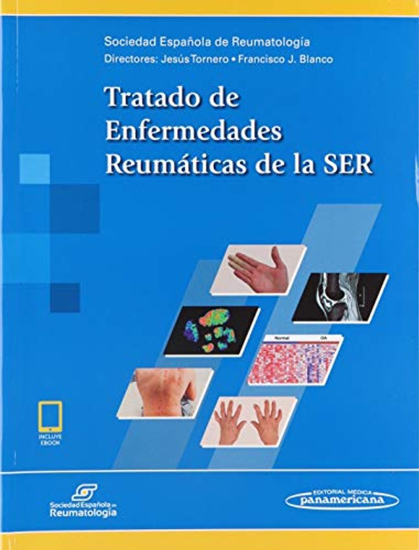 Libros Tratado de Enfermedades Reumáticas de la SER