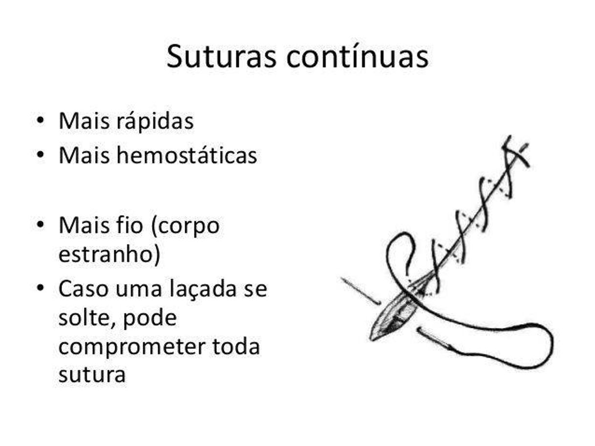 Moda sutura