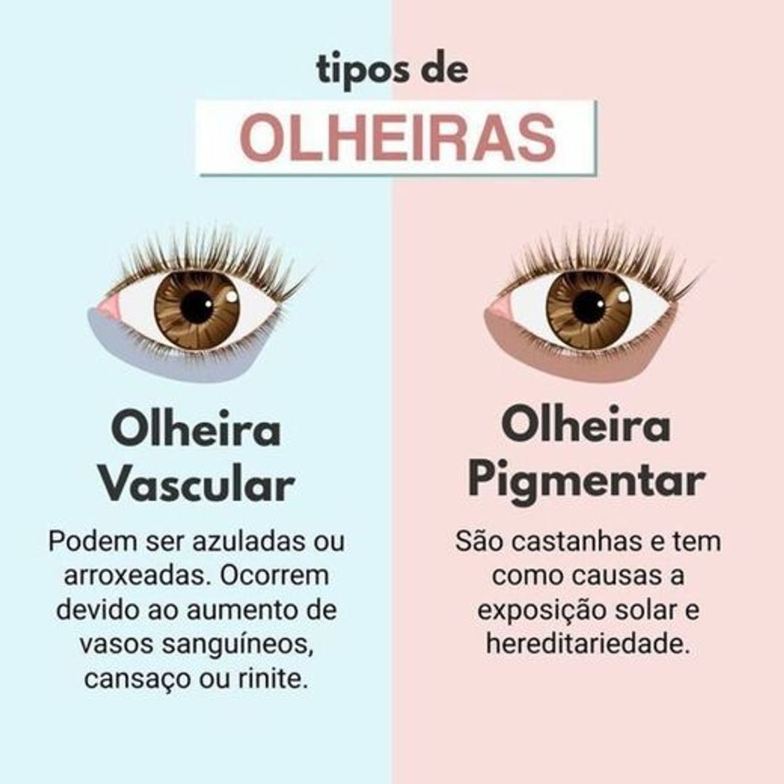 Moda tipos de olheiras