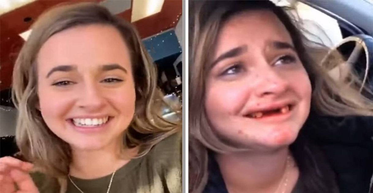 Moda La chica que perdió los dientes por culpa de las mimosas