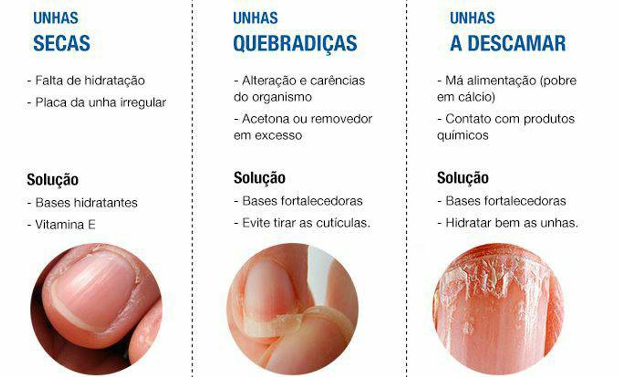 Moda Dicas para unhas