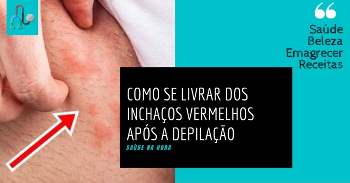 Moda Como Se Livrar Dos Inchaços Vermelhos Após a Depilação