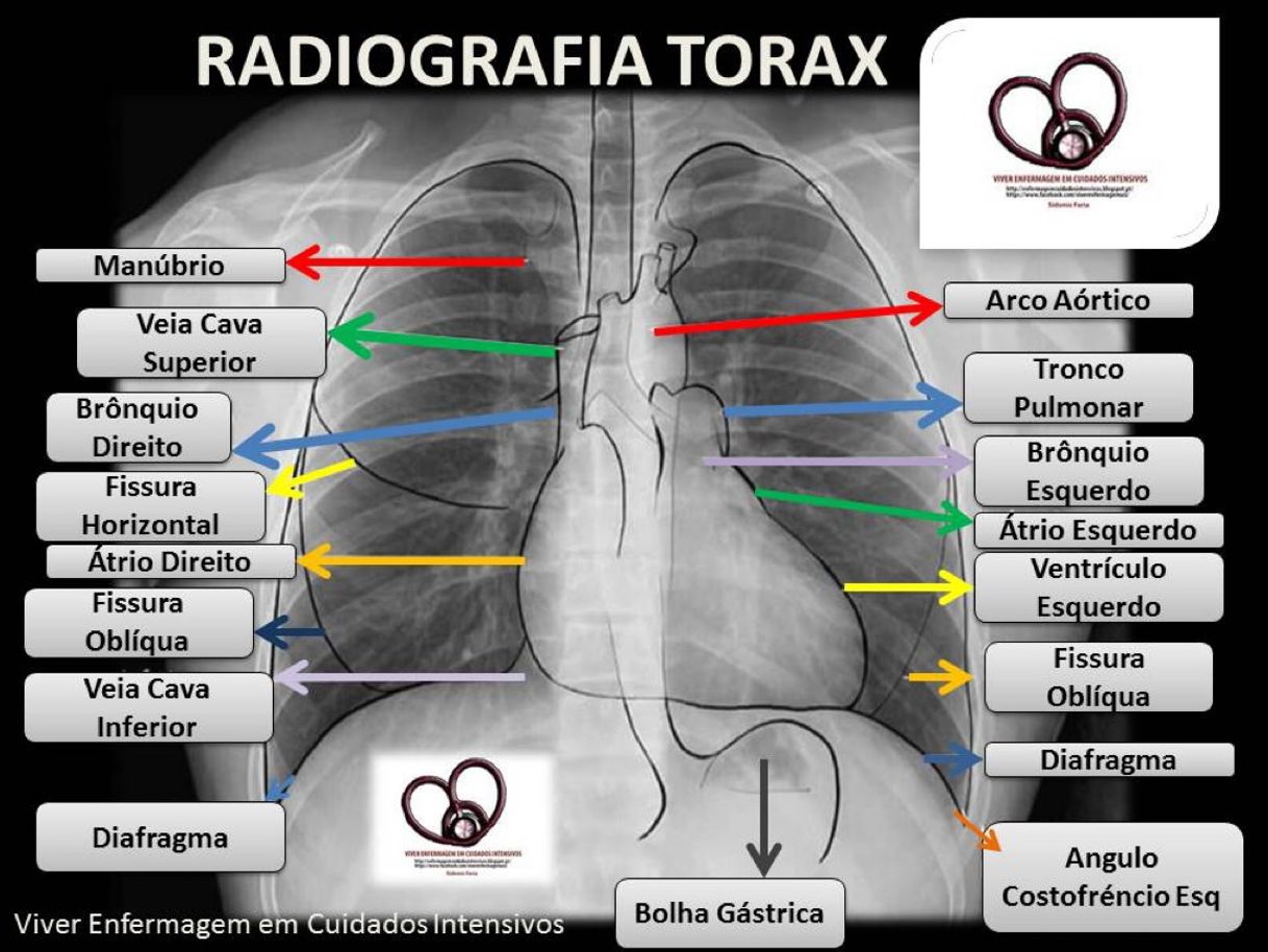 Moda Radiografia Tórax