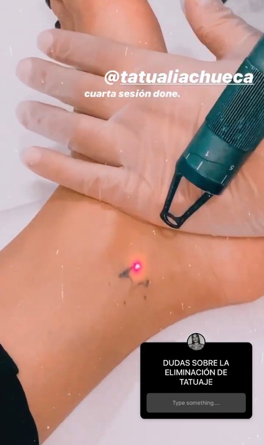 Moda Centro de Eliminación de Tatuajes