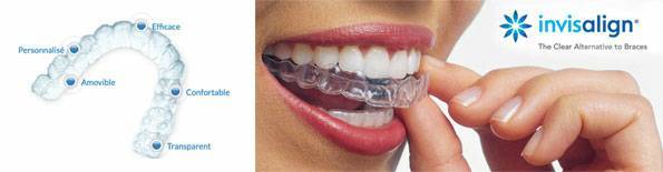 Fashion Invisalign