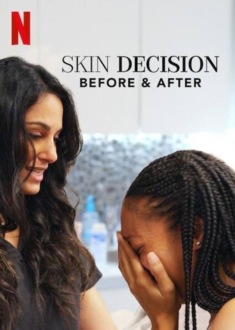 Series Skin Decision: Before and After