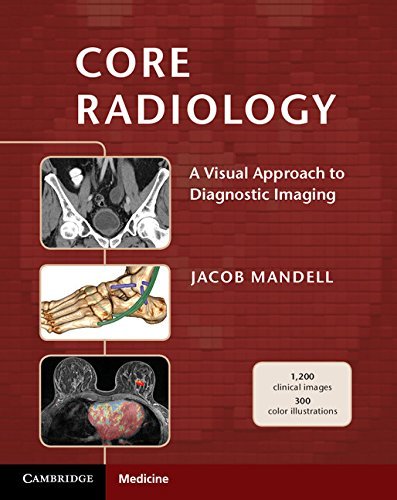 Producto Core Radiology