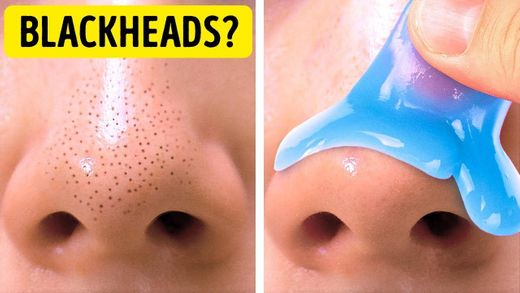 22 Clever solutions to improve your skincare