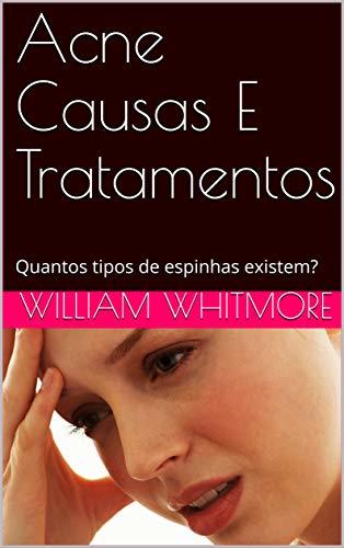 Products Acne Causas E Tratamentos: Quantos tipos de espinhas existem?