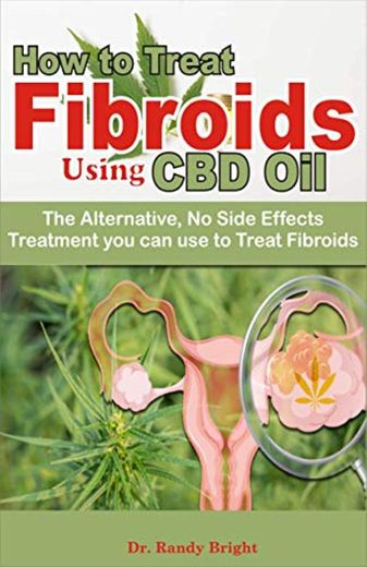How to Treat Fibriods Using CBD oil: The Alternative No Side Effects