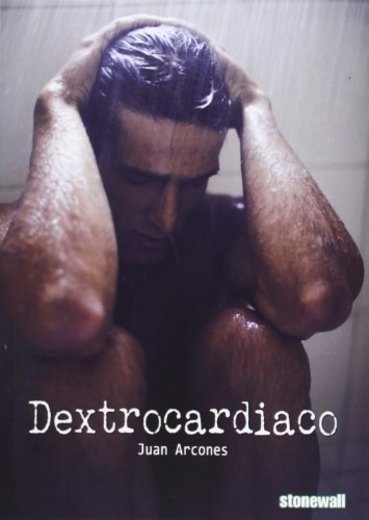 Dextrocardiaco