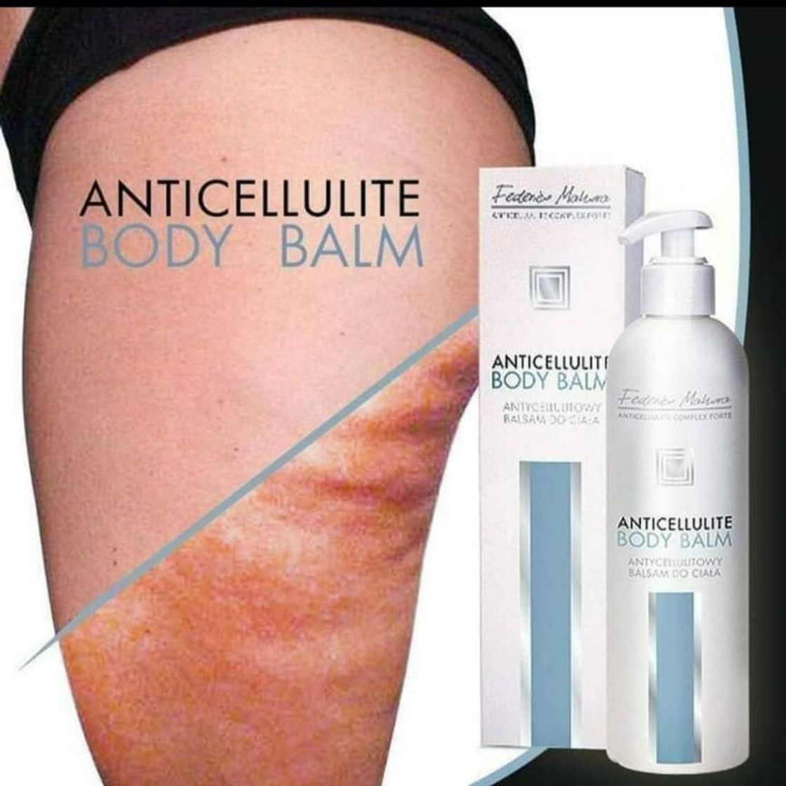 Producto Anti cellulitico 