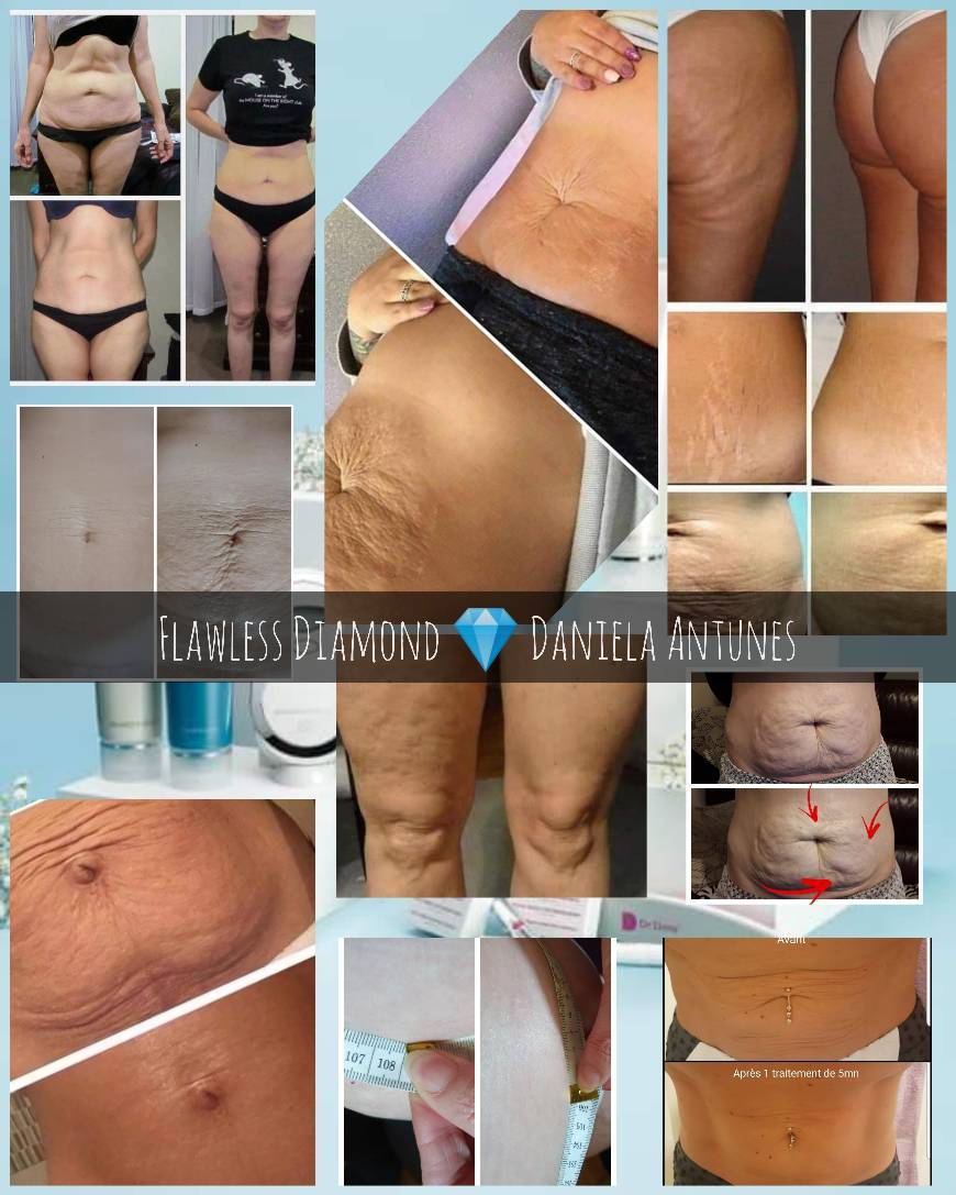 Product Galvanic Spa 💎