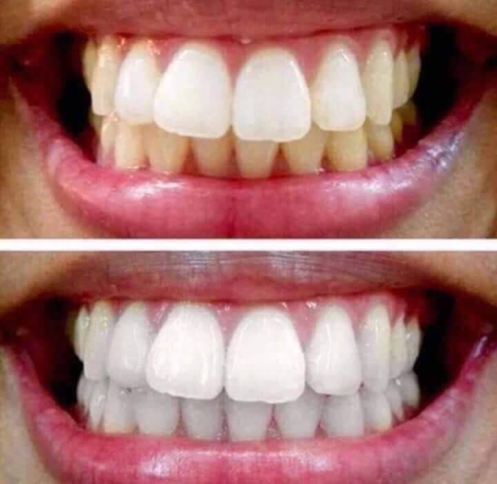 Product Pasta de dentes branqueadora 😊