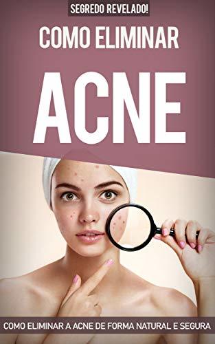 Social Acne: Como Eliminar a Acne de forma natural e segura sem precisar