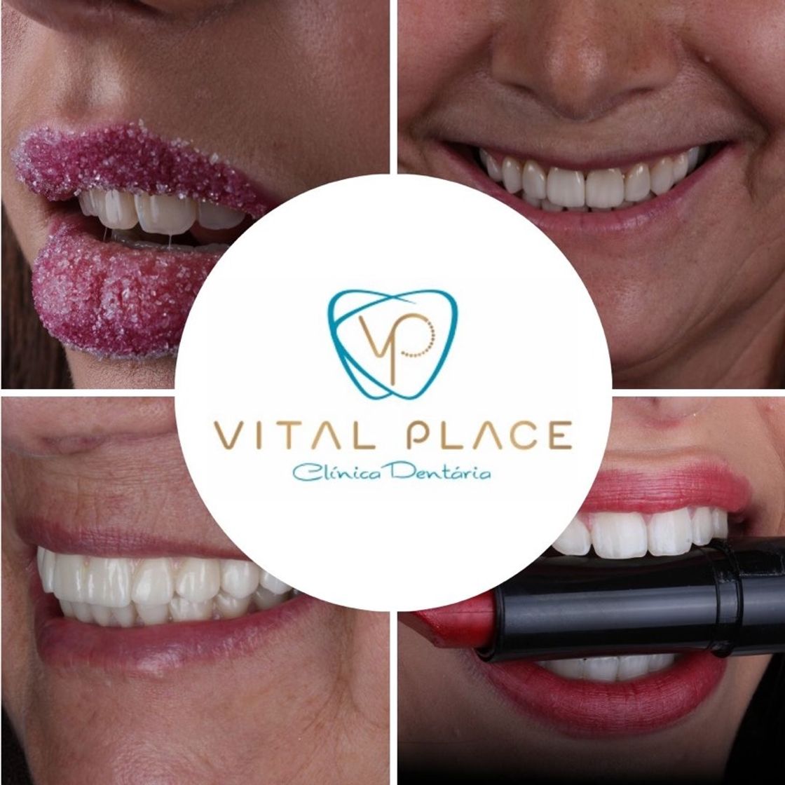 Producto Vitalplace - Clínica Dentária