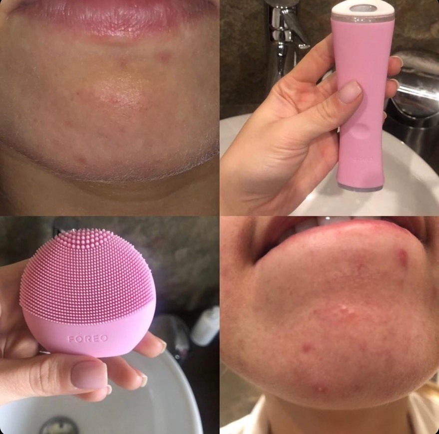 Producto Foreo ESPADA 