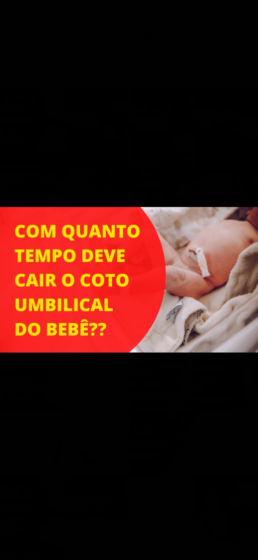 Fashion COM QUANTO TEMPO DEVE CAIR O COTO UMBILICAL DO BEBÊ??