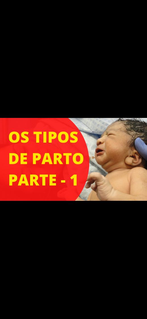 Fashion OS TIPOS DE PARTO 1 - YOUTUBE