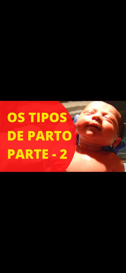 Fashion OS TIPOS DE PARTO 2 - YOUTUBE.