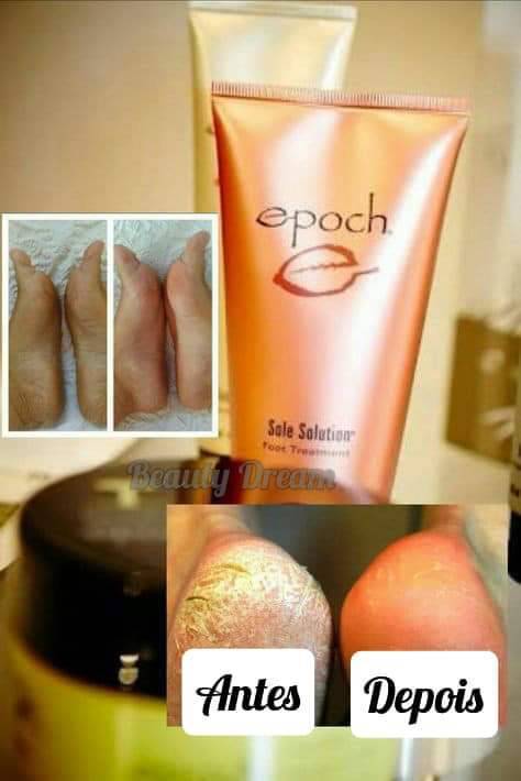 Moda Epoch Sole Solution