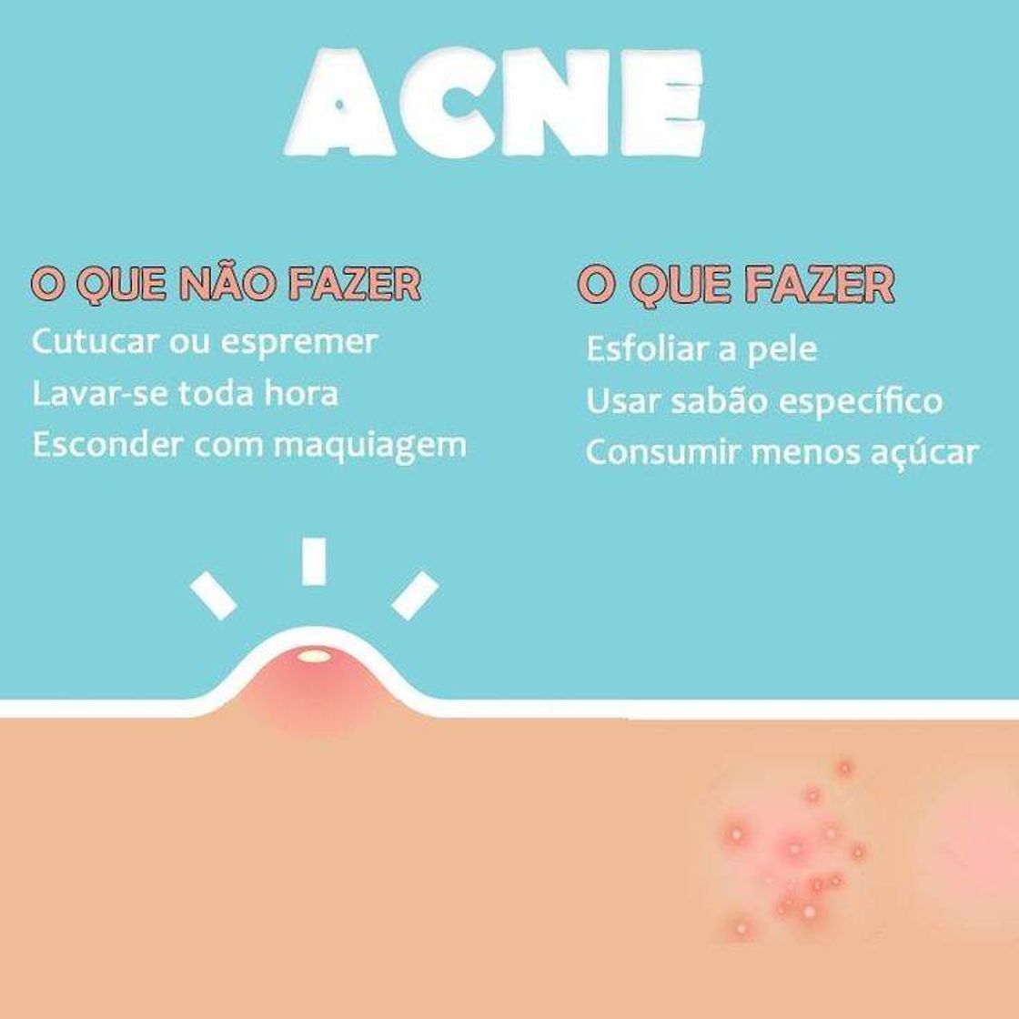 Moda Acne oq fazer?