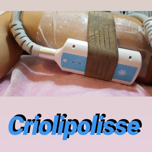 Criolipolisse 