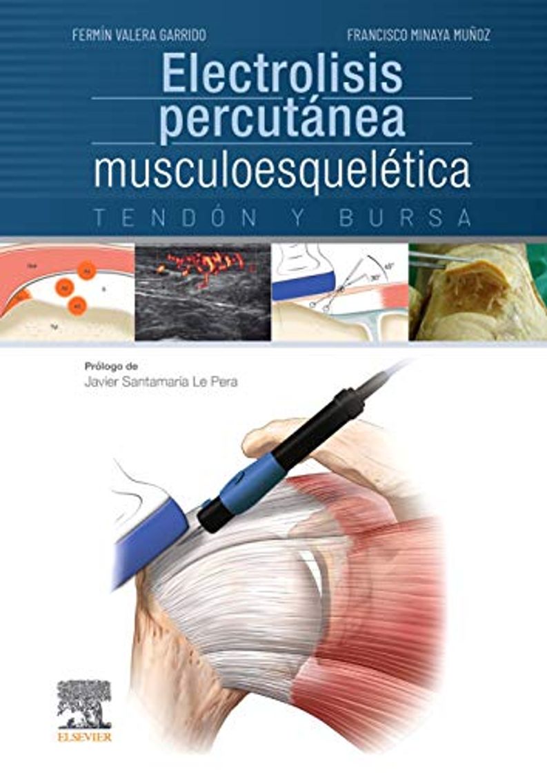 Book Electrolisis percutánea musculoesquelética. Tendón y bursa