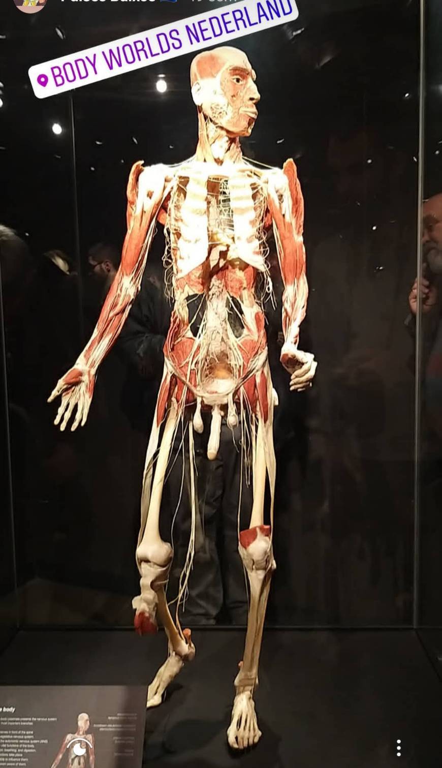 Place Body Worlds