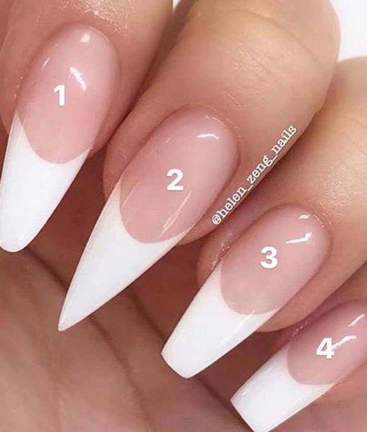 Unhas 