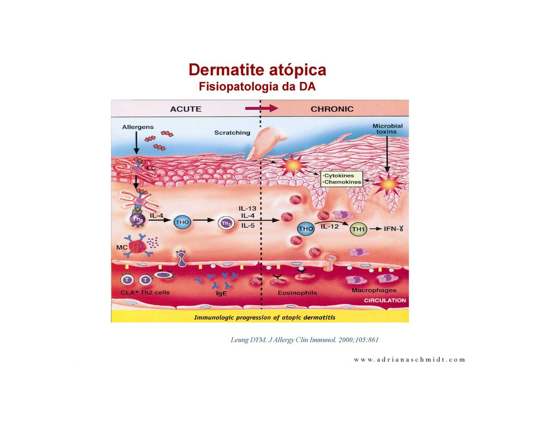 Producto Betnovate creme 30g para crises de pele atópica 