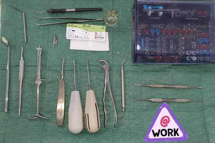 Implantes dentários