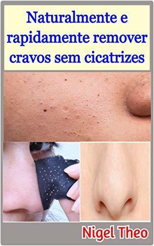 Products Naturalmente e rapidamente remover cravos sem cicatrizes