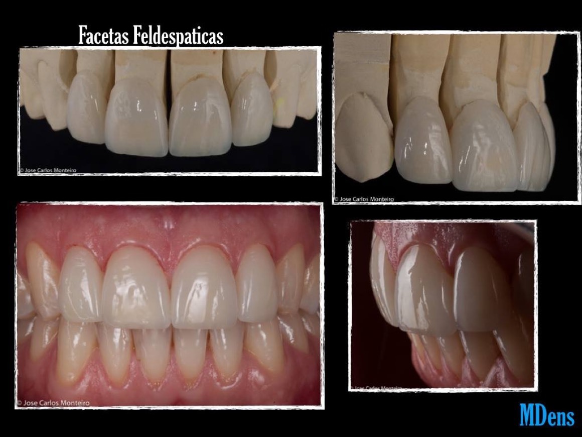 Lugar MDens de JCM - Estética Dentária, Lda