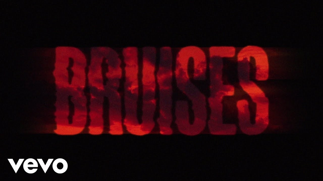 Music Lewis Capaldi - Bruises