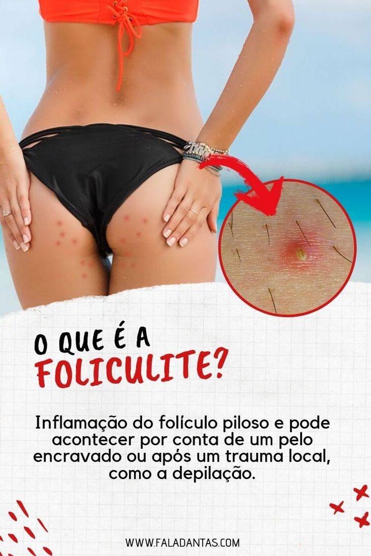 Moda Foliculite