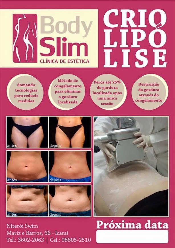 Lugar Body Slim estética 