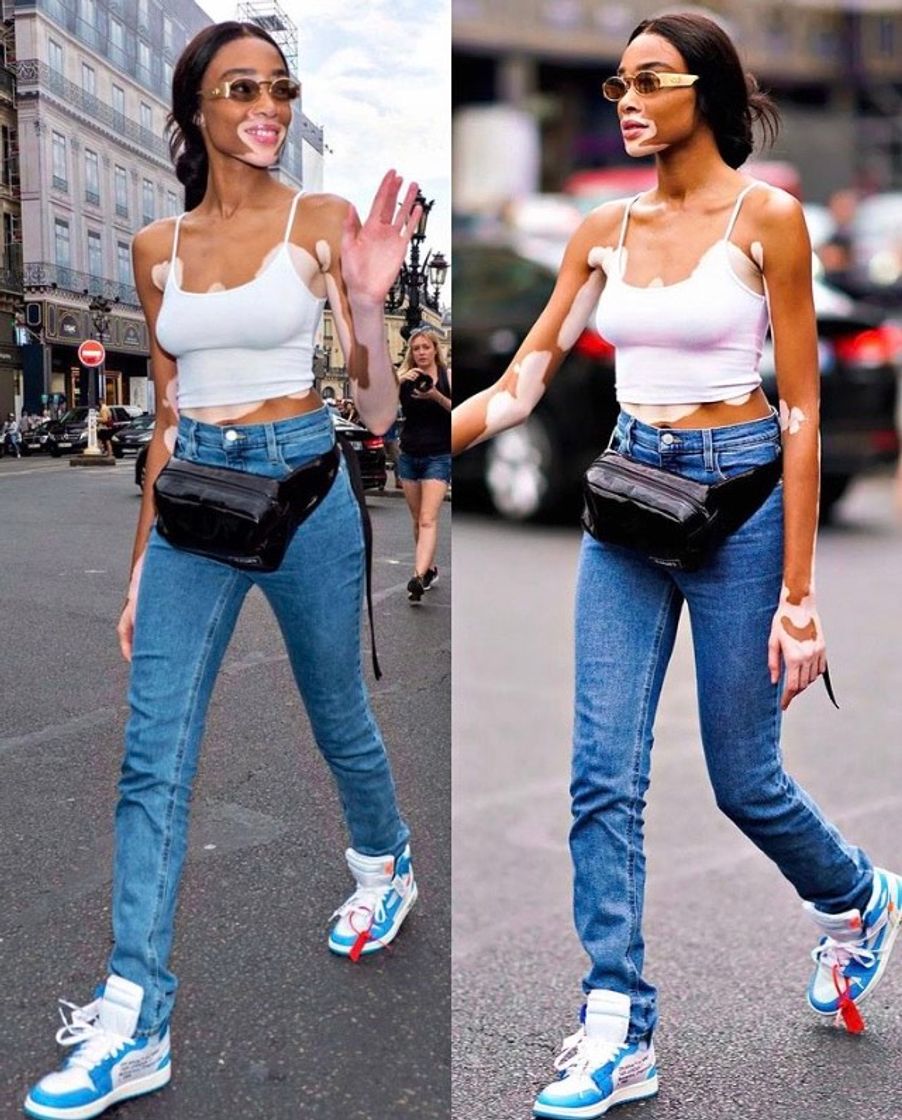 Fashion Modelo Winnie Harlow 