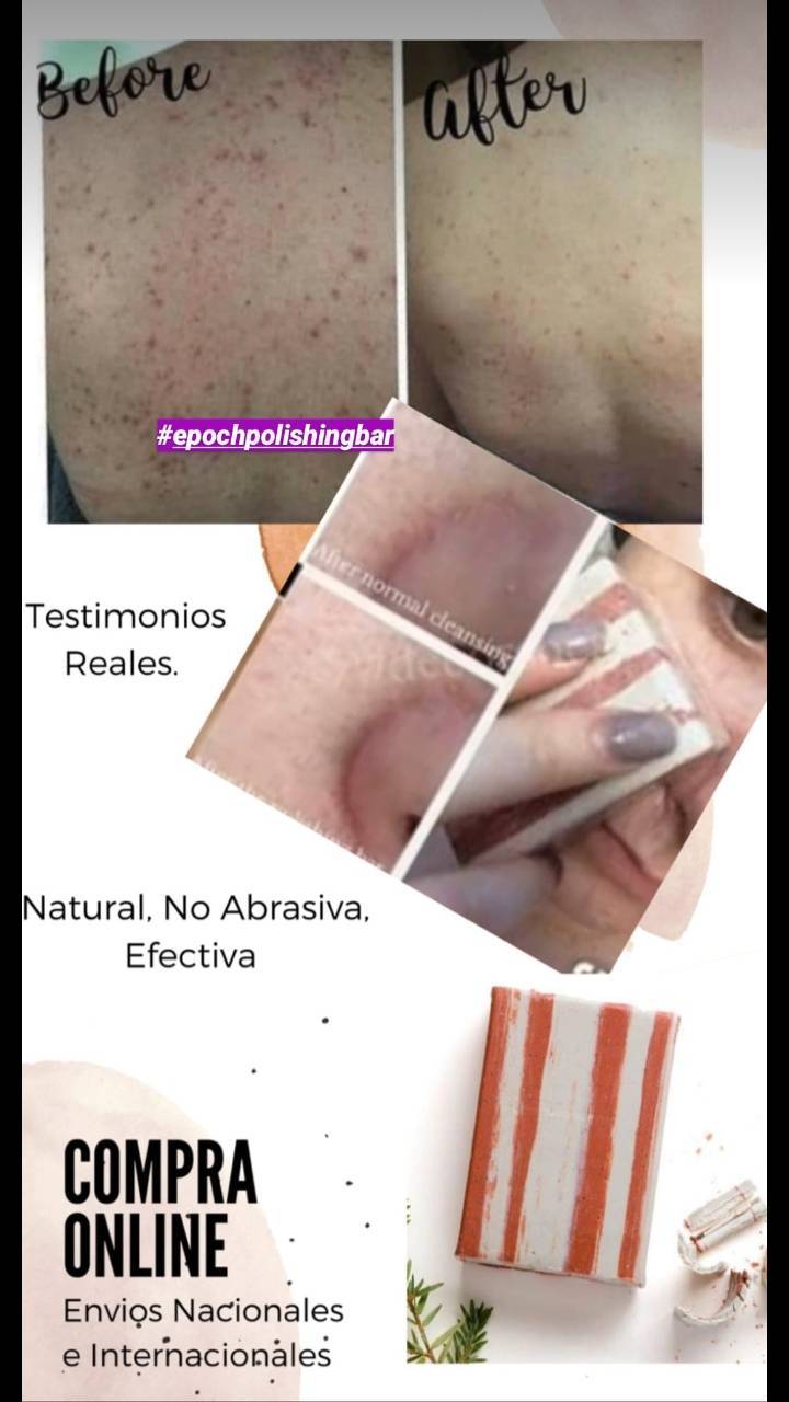 Sobre Epoch polishing bar 🔖💚