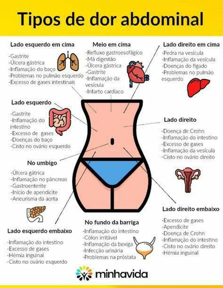 Moda Tipos de dores abdominais 