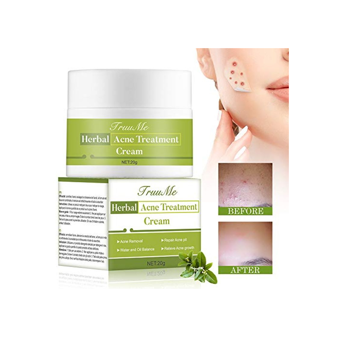 Product Crema Antiacne