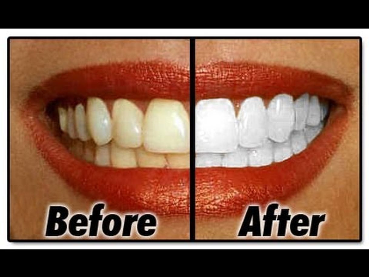 Social BLANQUEA tus dientes en MINUTOS! (remedio casero)