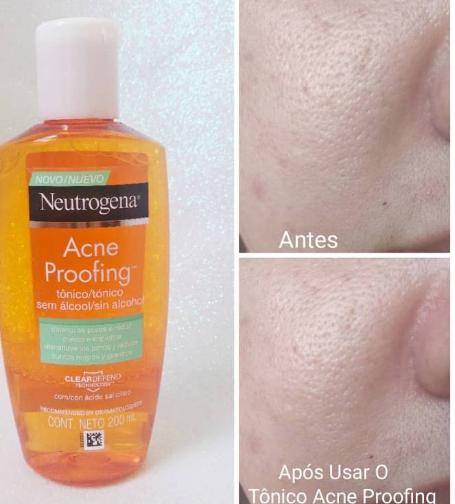 Producto Gel de Limpeza Acne Proofing NEUTROGENA