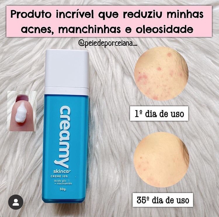 Producto acne 👊🏼