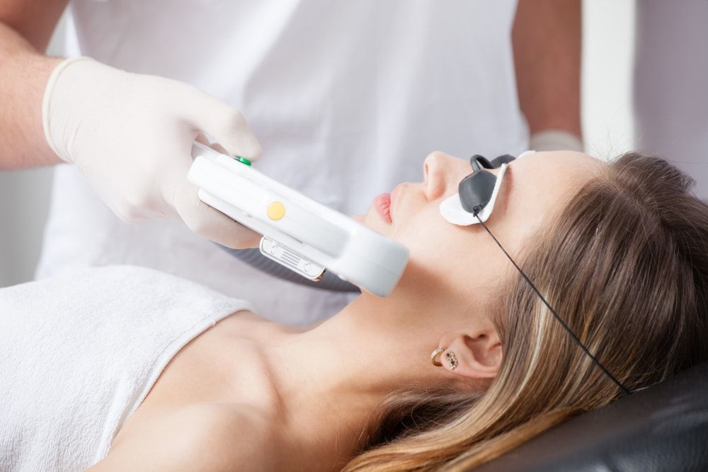 Moda Laser facial para tratar el acné 