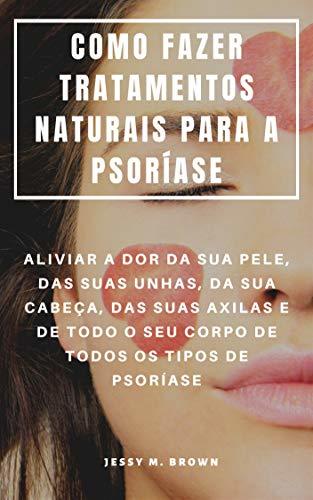 Lugares COMO FAZER TRATAMENTOS NATURAIS PARA A PSORÍASE : ALIVIAR A DOR DA