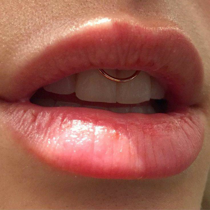 Social Smile